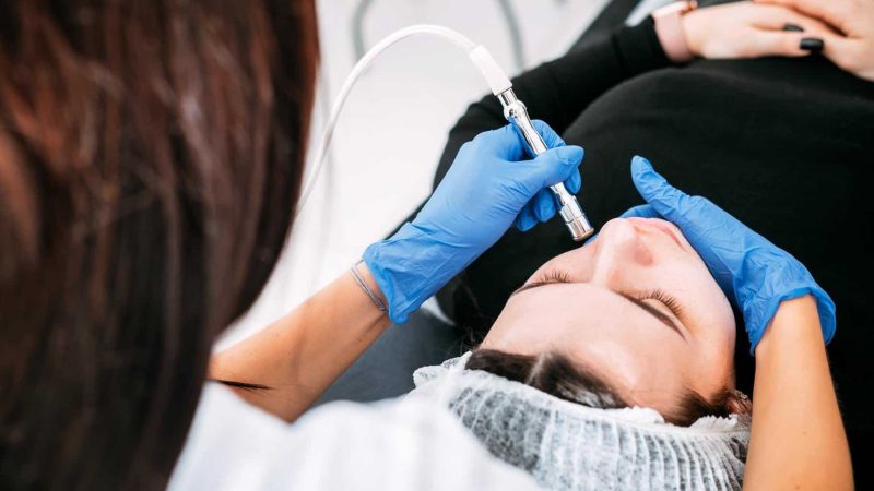 What is Microdermabrasion?