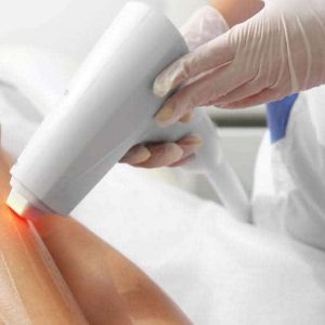 What is Laser Hair Removal